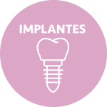 dibujo implantes
